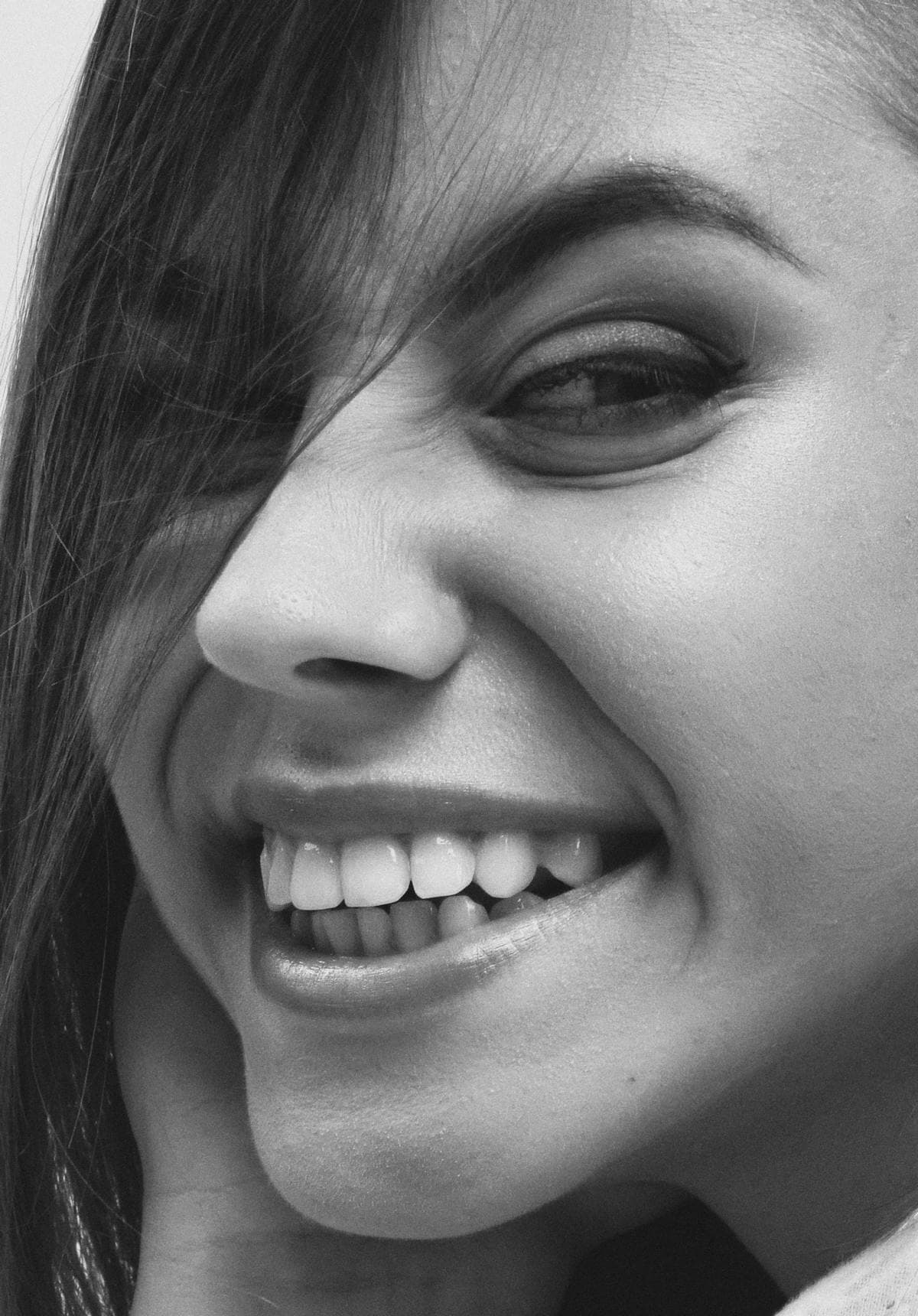 Porcelain veneer smile makeover — 10 upper veneers